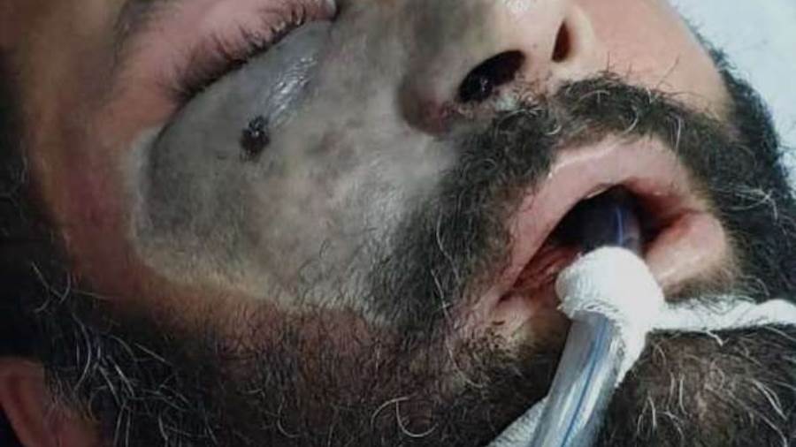 الفطر الأسود