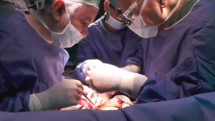 زراعة الكبد - صورة أرشيفية