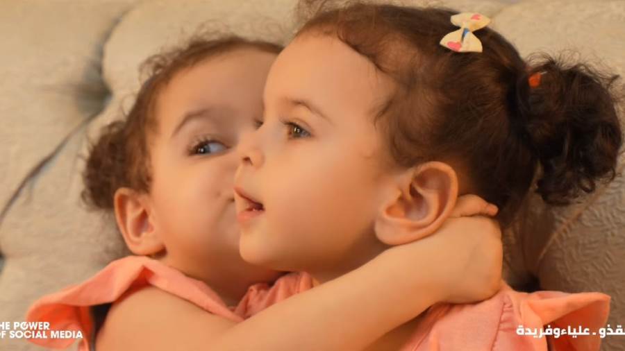 التوأم علياء وفريدة