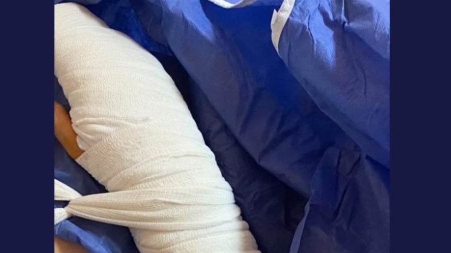 صورة العملية