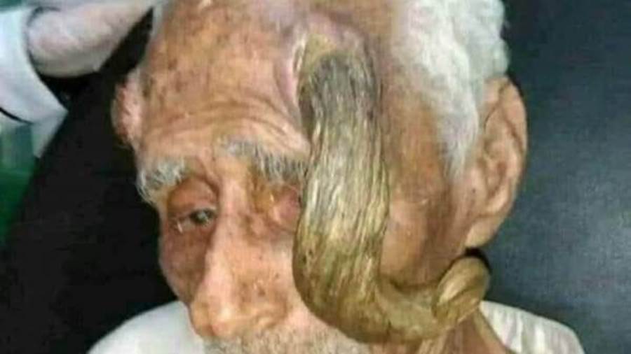 وفاة أكبر معمر يمني عن عمر تجاوز 140 عاما