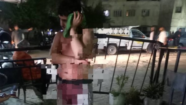 الشاب المصاب  الشاب المصاب