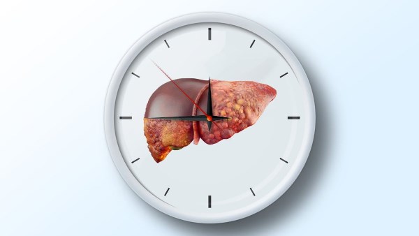 جمعية رعاية مرضى الكبد تكمل تنفيذ مبادرة طبية للكشف عن أمراض الكبد والباطنة