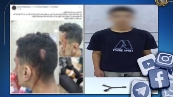 ضبط شخص قام بالتعدي على آخر باستخدام قطعة حديدية بالشرقية