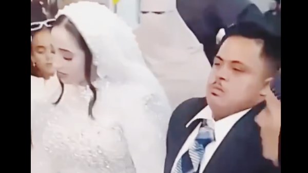 عريس متلازمة داون عريس متلازمة داون