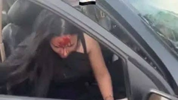 جانب من الحادث جانب من الحادث