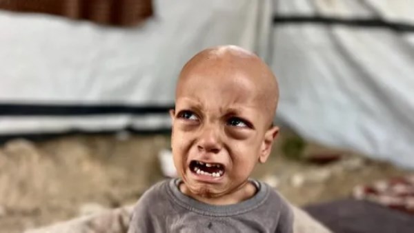  الطفل الفلسطيني عبد الله