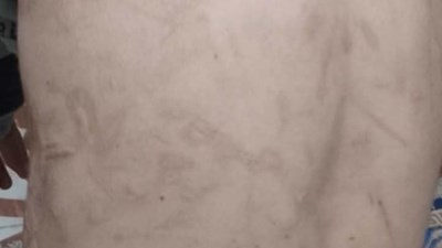 تعذيب طفل لسنوات داخل أسرته بالفيوم