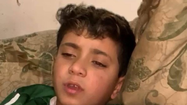 ضحية عقر كلب 