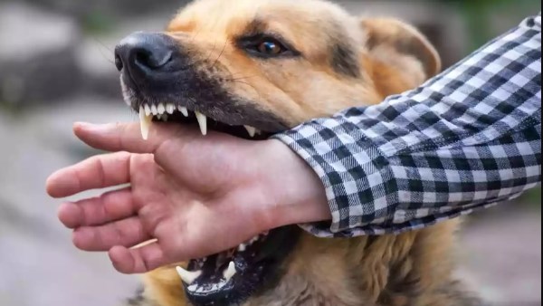 عضة الكلاب الضالة 