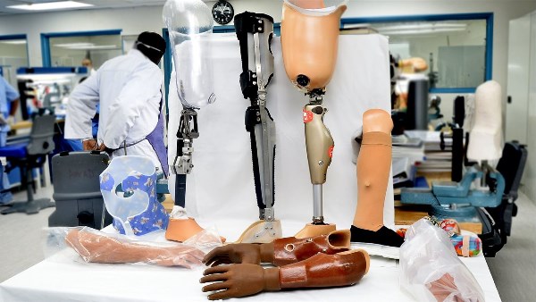 توطين صناعة الأطراف الصناعية 