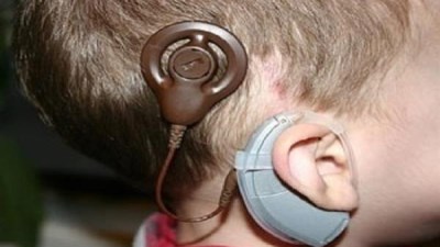 زراعة قوقعة أذن 