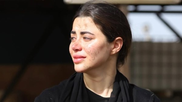 يارا السكري