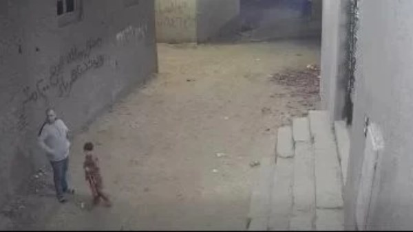 حقيقة بتر قدم طفل باسوس المصاب بطلق خرطوش القليوبية