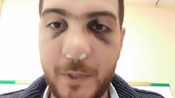 طبيب العظام المعتدي عليه