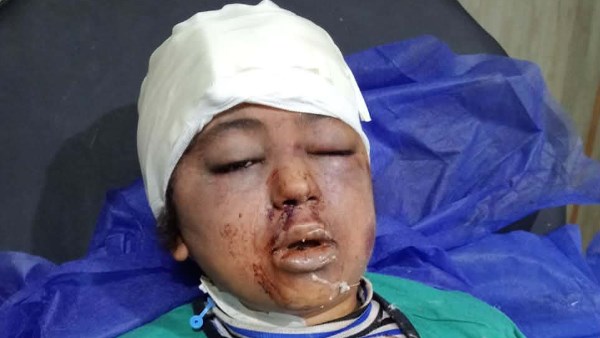 جويرية إحدى ضحايا الحادث