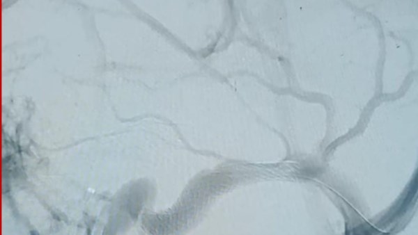 مستشفى دمنهور 