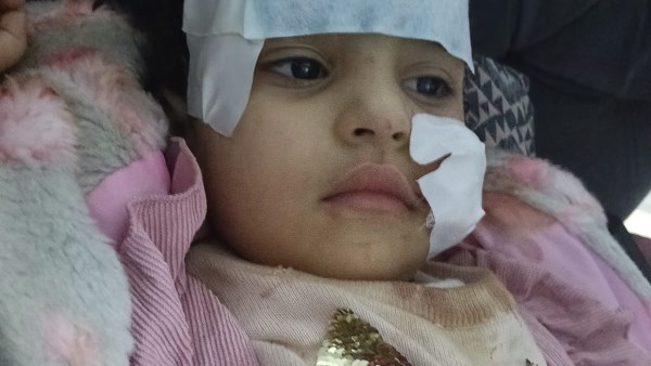 طفلة 3 سنوات تتعرض لهجوم أسد في السيرك القومي بالعجوزة وتُنقل للمستشفى