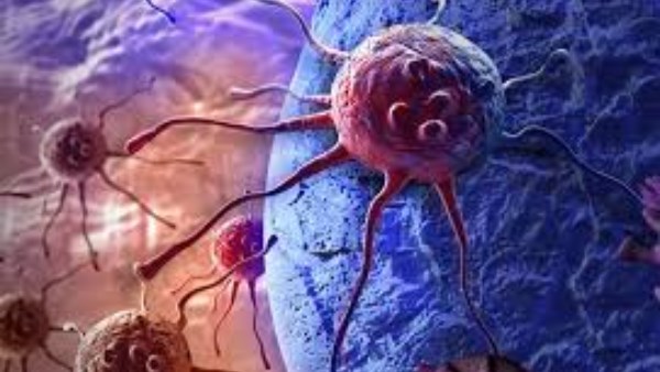 علاج الأورام 