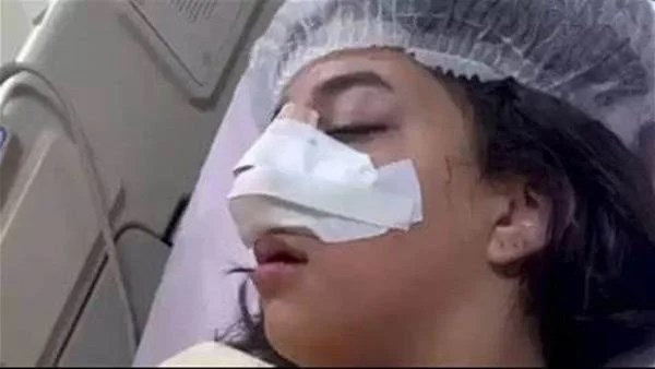 عرض الطالبة كارما على لجنة طب شرعي لحسم وجود عاهة مستديمة بعد التعدي عليها 