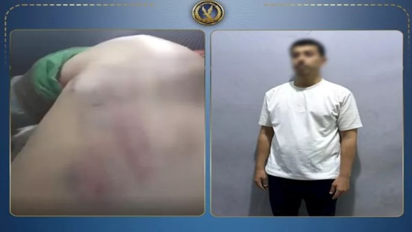 ا لتحريات: الضرب بسبب غياب شقيق الطفل عن الحصة