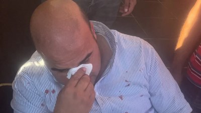 الاعتداء على نائب رئيس مدينة رأس البر