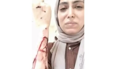 طبيبة أسنان شبرا