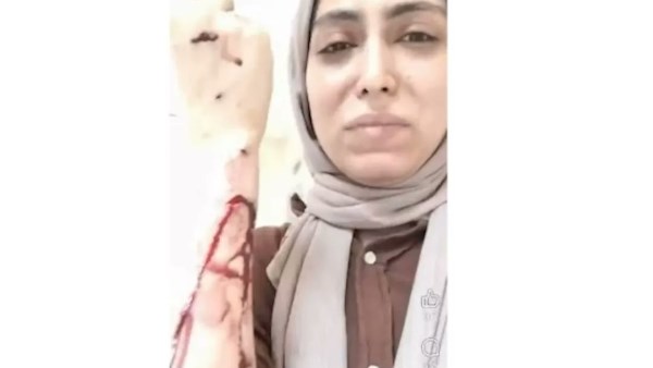 طبيبة أسنان شبرا