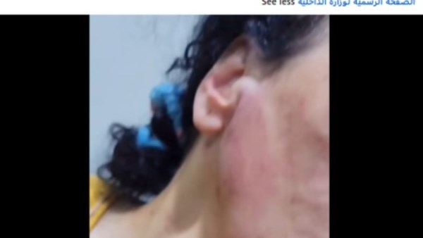 المجني عليها